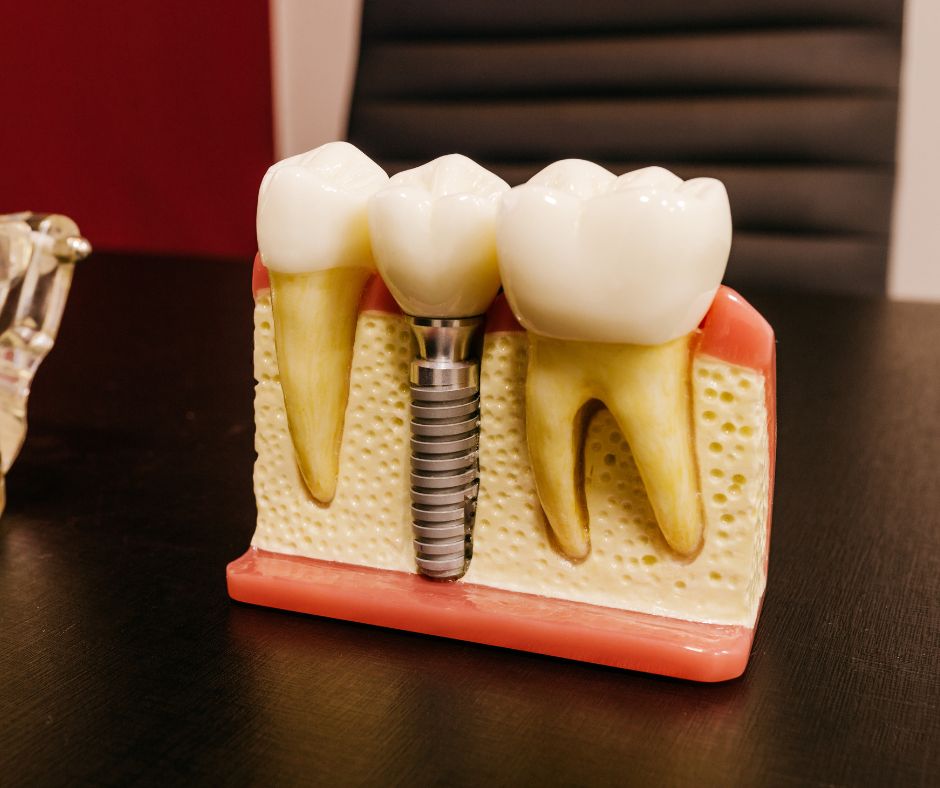 Prótesis dental